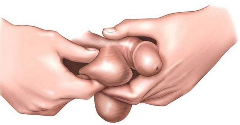 ¿Por qué los huevos pica en los hombres